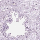 Immunohistochemical staining of human prostate shows low expression as expected.