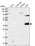 Anti-ZNF385B Antibody