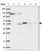 Lane 1: Marker [kDa] 250, 130, 95, 72, 55, 36, 28, 17, 10_br/_Lane 2: Human cell line RT-4_br/_Lane 3: Human cell line U-251MG sp_br/_Lane 4: Human plasma (IgG/HSA depleted)_br/_Lane 5: Human liver tissue_br/_Lane 6: Human tonsil tissue