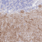 Anti-GNG13 Antibody