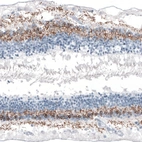 Immunohistochemical staining of human eye, retina shows moderate membranous positivity in neuronal cells.