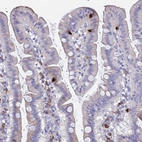 Immunohistochemical staining of human duodenum shows strong positivity in enteroendocrine cells.