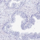 Immunohistochemical staining of human prostate shows no positivity in glandular cells as expected.