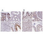 Anti-HNRNPUL1 Antibody