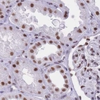 Immunohistochemical staining of human kidney using Anti-HNRNPUL1 antibody HPA046290.