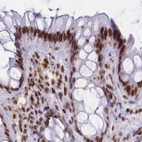 Immunohistochemical staining of human colon using Anti-HNRNPUL1 antibody HPA046290.