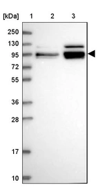 Lane 1: Marker [kDa] 250, 130, 95, 72, 55, 36, 28, 17, 10_br/_Lane 2: Human cell line RT-4_br/_Lane 3: Human cell line U-251MG sp