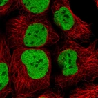 Immunofluorescent staining of human cell line HEK 293 shows localization to nucleoplasm.