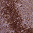 Anti-SNX21 Antibody