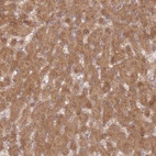 Immunohistochemical staining of human liver shows moderate cytoplasmic additional nuclear membranous positivity in hepatocytes.
