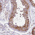 Immunohistochemical staining of human testis shows strong cytoplasmic-membranous/nuclear membranous positivity in cells in seminiferous ducts.