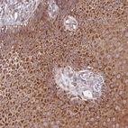Immunohistochemical staining of human skin shows strong cytoplasmic additionally nuclear membranous positivity in squamous epithelial cells.