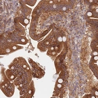 Immunohistochemical staining of human duodenum shows strong cytoplasmic-membranous positivity in glandular cells.