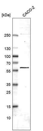 Western blot analysis in human cell line CACO-2.