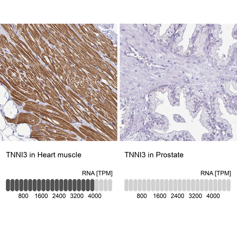 Anti-TNNI3 Antibody