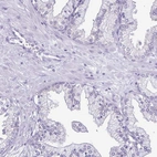 Immunohistochemical staining of human prostate shows low expression as expected.