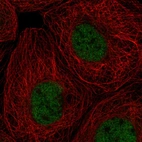 Immunofluorescent staining of human cell line A-431 shows localization to nucleoplasm.