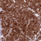 Immunohistochemical staining of human pancreas shows strong cytoplasmic positivity in exocrine glandular cells.