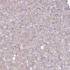 Immunohistochemical staining of human liver shows very weak cytoplasmic positivity in hepatocytes.