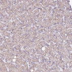 Immunohistochemical staining of human liver shows very weak cytoplasmic positivity in hepatocytes.