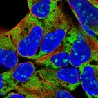 Immunofluorescent staining of human cell line HEK 293 shows localization to nucleoli, cytosol & endoplasmic reticulum.