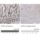Anti-ZFPM1 Antibody