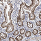 Anti-ZFPM1 Antibody