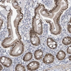 Immunohistochemical staining of human duodenum shows strong nuclear positivity in glandular cells.