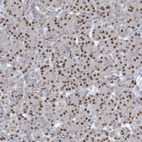 Anti-ZFPM1 Antibody