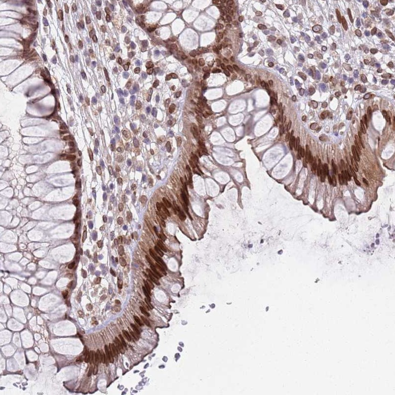 Anti-C1orf145 Antibody