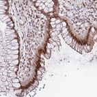 Anti-C1orf145 Antibody