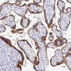 Anti-EBI3 Antibody