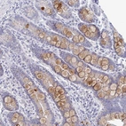 Immunohistochemical staining of human duodenum shows moderate cytoplasmic positivity in goblet cells.