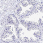 Anti-EBI3 Antibody