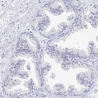 Immunohistochemical staining of human prostate shows no positivity in glandular cells as expected.
