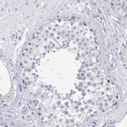 Immunohistochemical staining of human testis shows no positivity in cells in seminiferous ducts as expected.