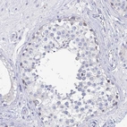 Immunohistochemical staining of human testis shows no positivity in cells in seminiferous ducts as expected.
