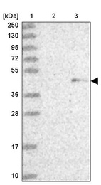 Lane 1: Marker [kDa] 250, 130, 95, 72, 55, 36, 28, 17, 10_br/_Lane 2: Human cell line RT-4_br/_Lane 3: Human cell line U-251MG sp