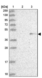 Anti-ZNF239 Antibody