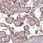 Anti-WASHC4 Antibody