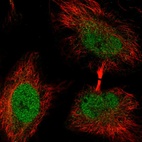 Immunofluorescent staining of human cell line HeLa shows localization to nucleoplasm.