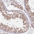 Anti-KANSL1L Antibody