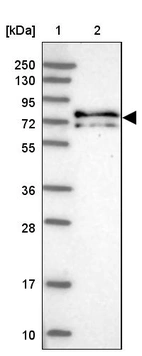 Lane 1: Marker [kDa] 250, 130, 95, 72, 55, 36, 28, 17, 10_br/_Lane 2: Human cell line RT-4