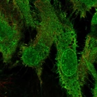 Anti-GRK5 Antibody