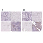 Immunohistochemical staining of human endometrium, liver, skeletal muscle and tonsil using Anti-DSG3 antibody HPA046864 (A) shows similar protein distribution across tissues to independent antibody HPA056863 (B).