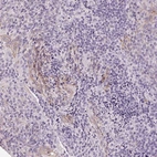 Immunohistochemical staining of human tonsil shows moderate membranous positivity in squamous epithelial cells.