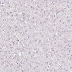 Immunohistochemical staining of human liver shows no positivity in hepatocytes.