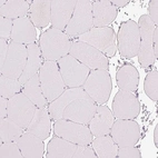 Immunohistochemical staining of human skeletal muscle shows no positivity in myocytes.