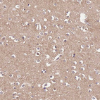 Anti-FAM89B Antibody