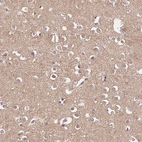 Immunohistochemical staining of human cerebral cortex shows moderate cytoplasmic positivity in neuropil.